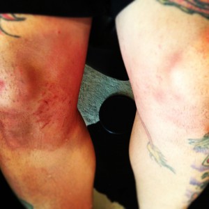 Lee's knee